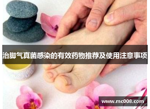 治脚气真菌感染的有效药物推荐及使用注意事项